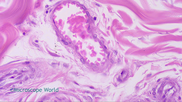 Microscopy image of skin infected with Rocky Mountain Spotted Fever captured at 400x magnification by Microscope World.