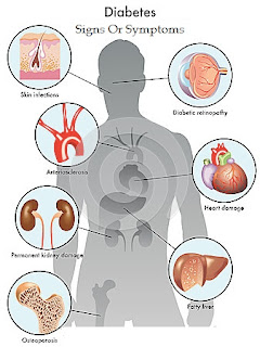Diabetes, Signs or symptoms