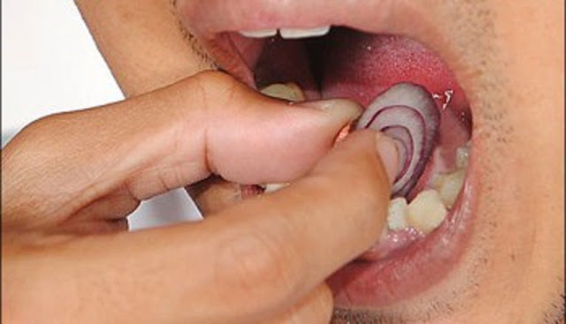 ¿Como tratar naturalmente un dolor de muelas o de diente? ¿Como tratar naturalmente un dolor de muelas o de diente?