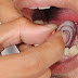 ¿Como tratar naturalmente un dolor de muelas o de diente?