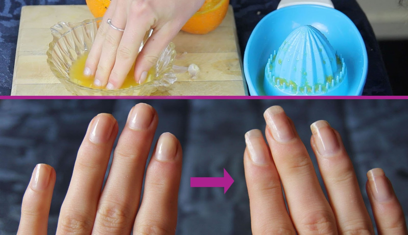How to care for your nails at home Stay Healthy