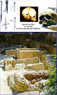 Λεπτή εγχείρηση εγκεφάλου στην Αρχαία πόλη της Χίου ! ! !