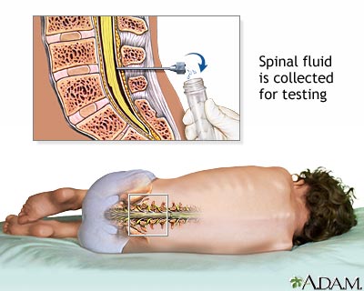 Position For Csf Collection Biochemistry Class notes: Cerebrospinal fluid (CSF) : Formation ...