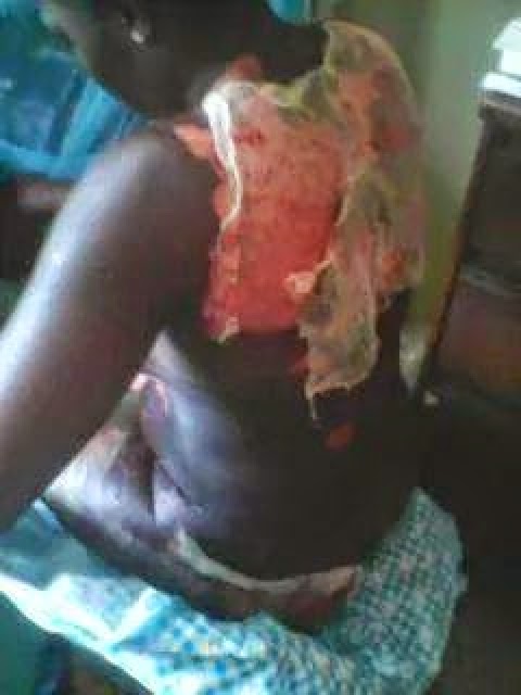 nigerian custom officer acid attack