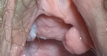 H i v virus in vagina