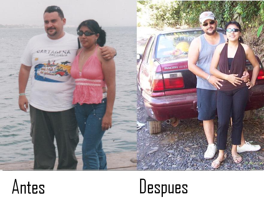 Auriculoterapia para adelgazar antes y despues