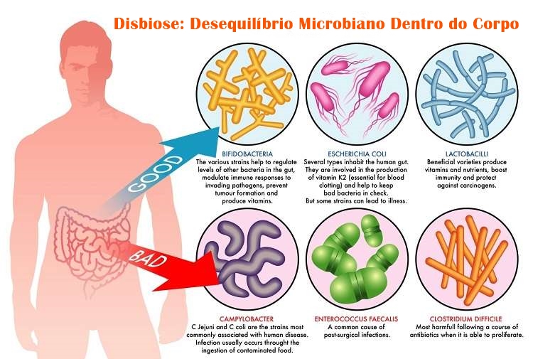 Disbiose: Desequilíbrio Microbiano Dentro do Corpo