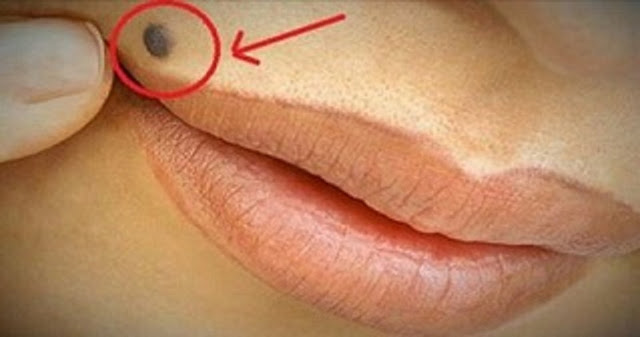 SI USTED TIENE UN LUNAR EN UNO DE ESTOS 7 LUGARES EN SU CUERPO ESTO ES LO QUE SIGNIFICA. ¡USTED SE SORPRENDERÁ! SI USTED TIENE UN LUNAR EN UNO DE ESTOS 7 LUGARES EN SU CUERPO ESTO ES LO QUE SIGNIFICA. ¡USTED SE SORPRENDERÁ!