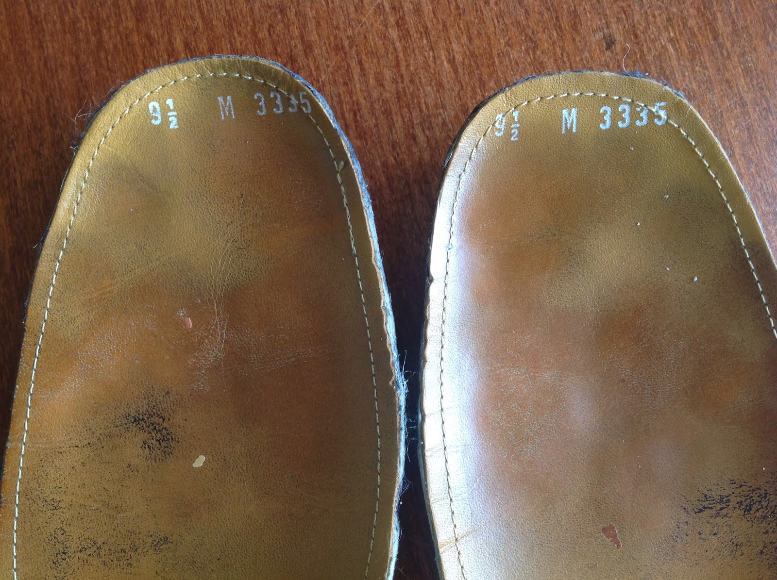 Foot and Ankle Problems By Dr. Richard Blake Monday's Image of the