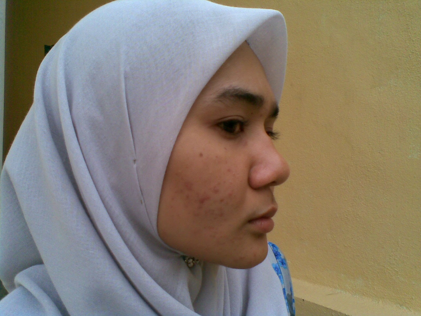 jenis%2Bjerawat.jpg