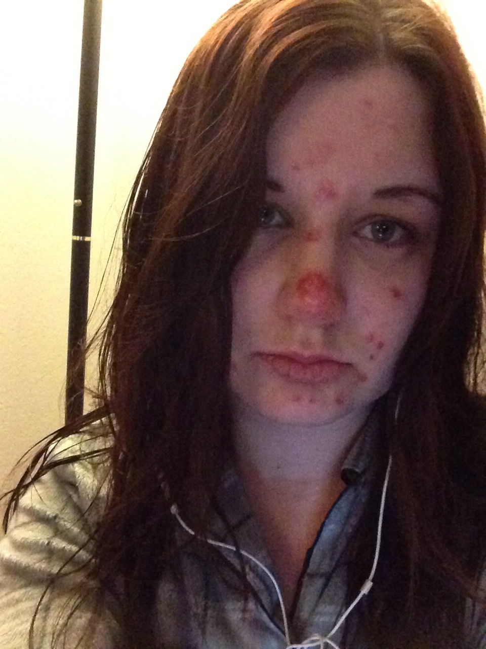 JulieBeautyOCD Skin Picking (Dermatillomania)