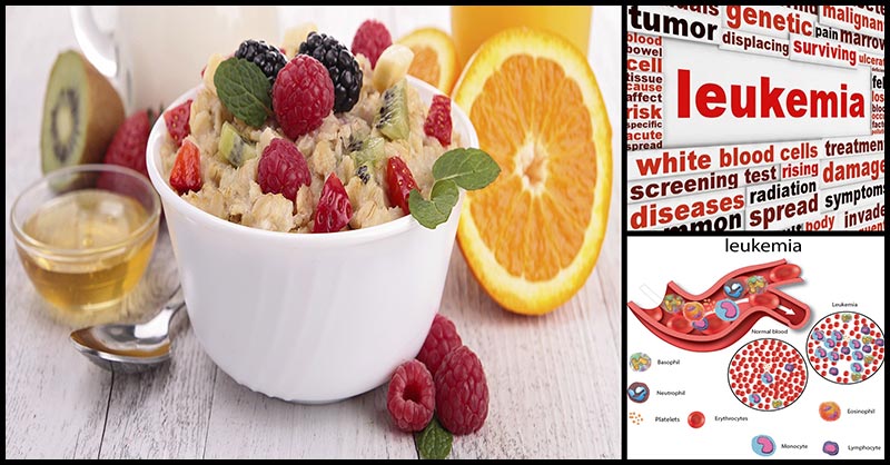 Diet And Nutrition Recommendations For Leukemia Patients Diet And Nutrition Recommendations For Leukemia Patients