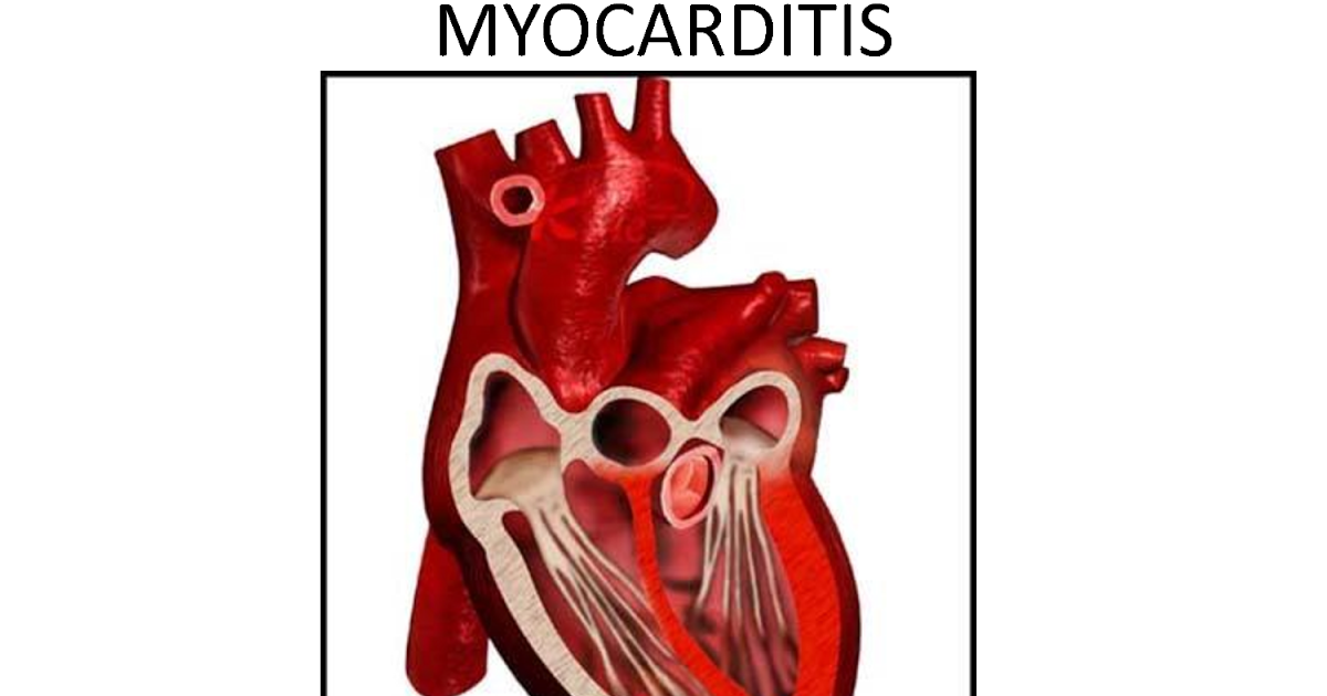 Миокардит у животных. Миокардит у животных. Экг при остром миокардите. Миокардит у животных. Миокардит у животных.