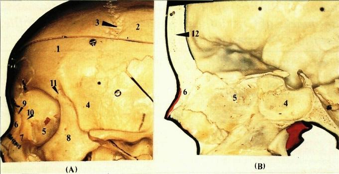 Dentistry lectures for MFDS/MJDF/NBDE/ORE: Note on Radiographic Anatomy