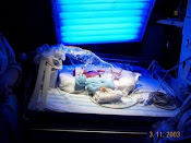 Dustin Tyler born at 25 weeks