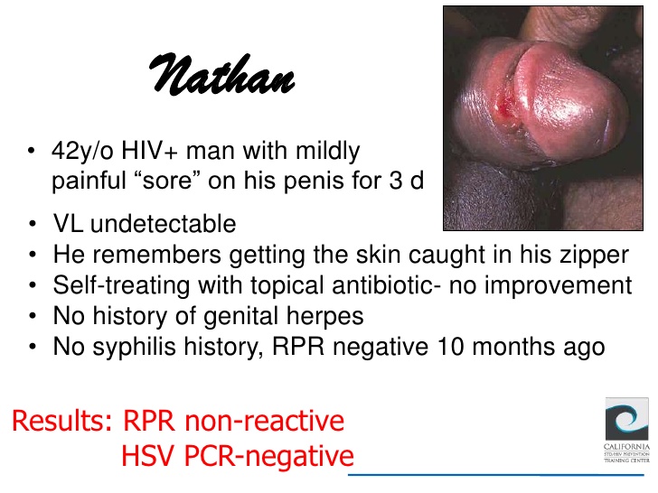 Lesbian Tentacle Hentai Hiv Symptoms On Penis