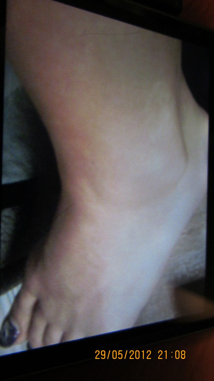 EAT WELL NATURALLY: Matrix Repatterning Treatment Three