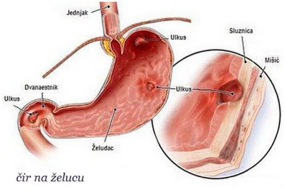 ne mogu izgubiti mast na želucu mrsavljenje uz nutribullet