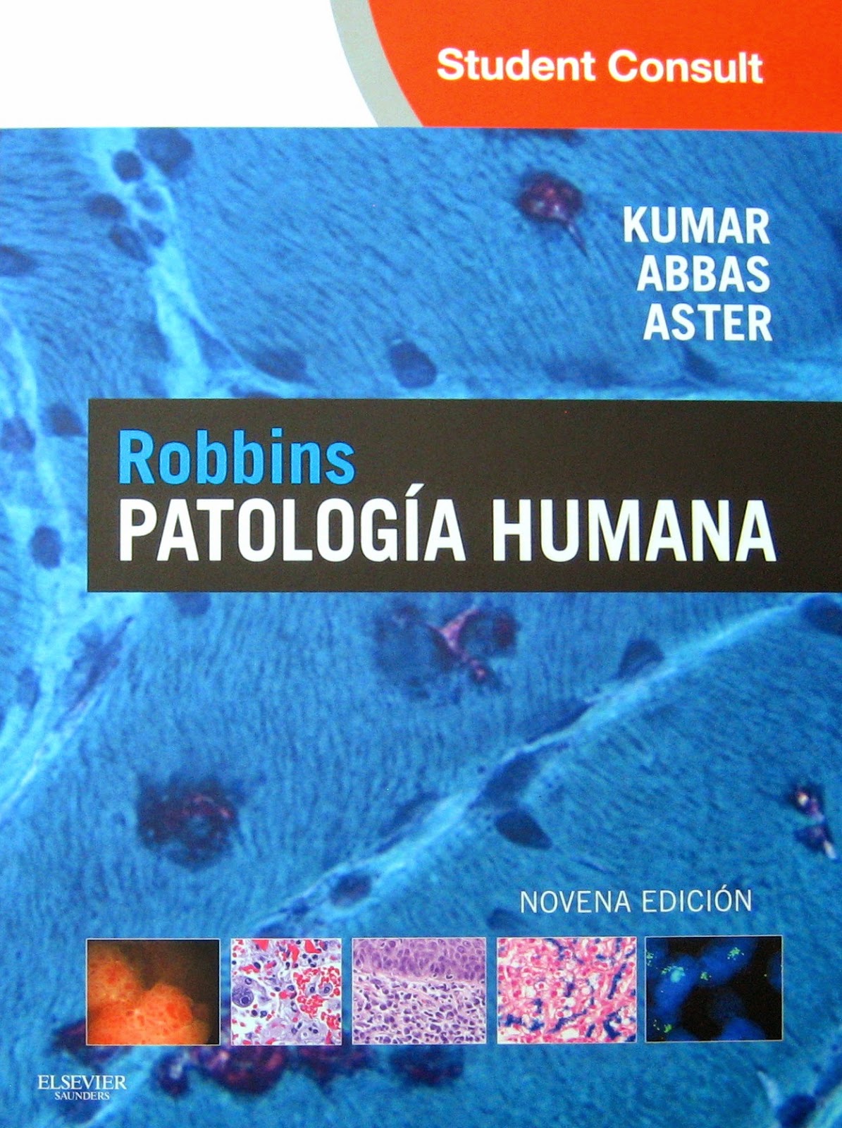 patologia de robbins 8 edicion pdf descargar gratis patologia de robbins 8 edicion pdf descargar gratis