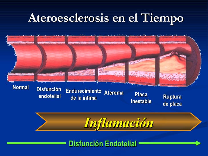Educación Alimentaria y Nutricional: Prevención, desde el embarazo, de las enfermedades Crónicas No Transmisibles