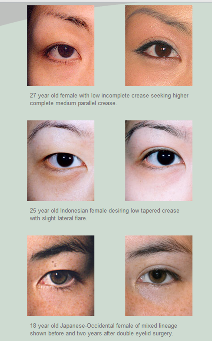 Kim's Korea Why living in Korea is good for my selfesteem...