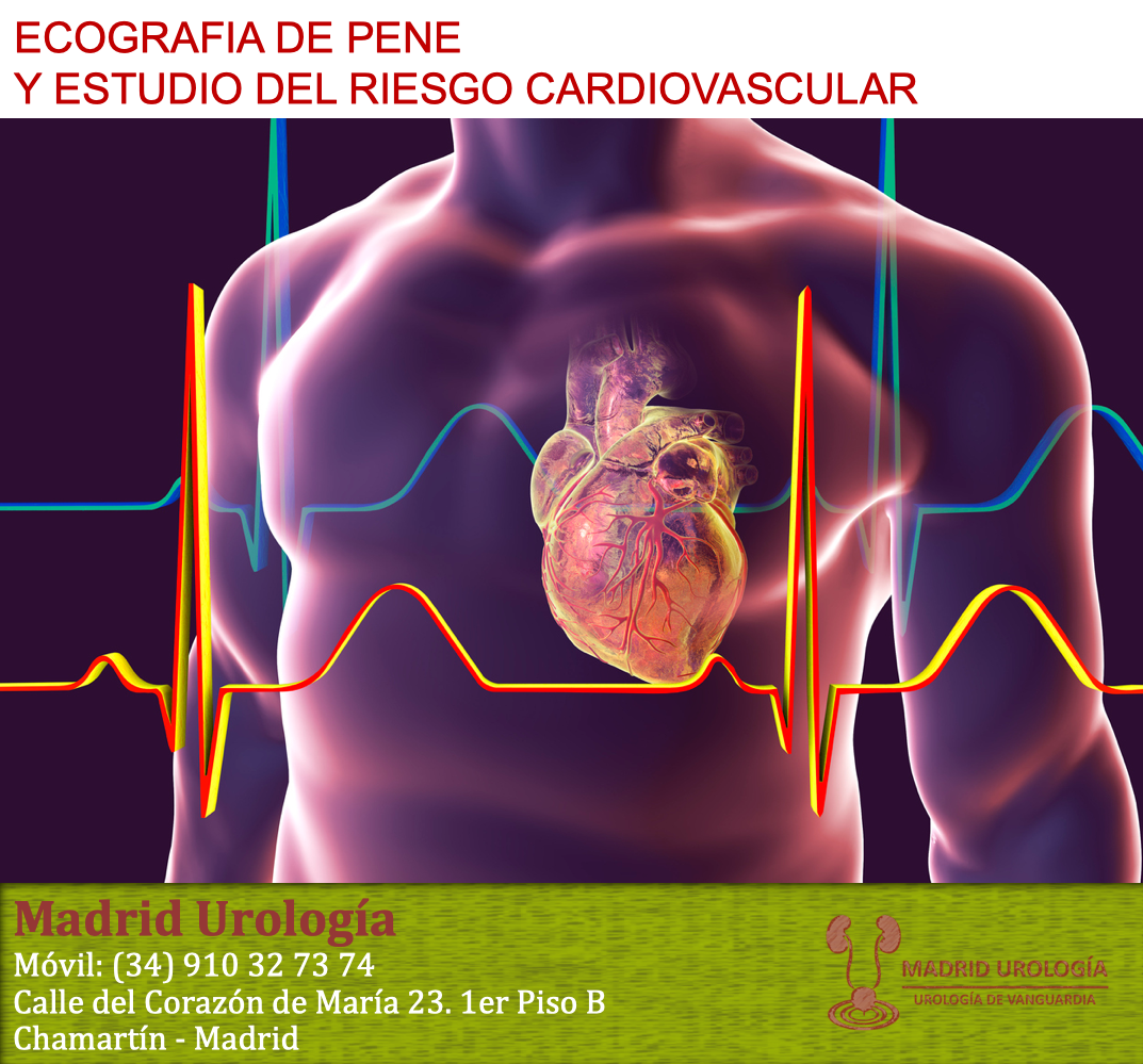 disfunción eréctil cardiopática disfunción eréctil cardiopática
