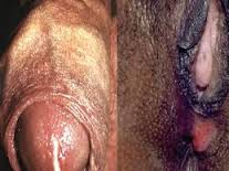 Tanda Sipilis Pada Lelaki
Terkena Sipilis
Tahapan Sifilis
Tanda Sipilis Wanita
Tatalaksana Sipilis
Tanda Sipilis Sembuh
Ubat Sifilis
Ubat Sifilis Malaysia
Ubat Sipilis Di Malaysia
Herbal Untuk Sipilis
Pengobatan Untuk Sipilis
Pengobatan sifilis secara alami
Cara pengobatan penyakit sipilis secara alami
Mengobati sipilis pada wanita
Cara menyembuhkan sipilis pada wanita
Cara mengobati sipilis pada wanita
Penanganan sifilis pada ibu hamil
Cara pengobatan tradisional penyakit sipilis
Mengobati penyakit sipilis secara alami
Cara mengobati sipilis secara alami
Pengobatan penyakit sifilis secara alami
Cara penyembuhan sipilis secara alami
Cara pengobatan sifilis secara alami
Pengobatan secara medis penyakit sipilis
Obat sipilis secara medis
Cara mengobati sipilis tanpa obat
Cara mengobati sipilis raja singa
Cara mengobati sipilis alami
Cara mengobati sipilis pada pria
Cara mengobati sipilis sendiri
Cara mengobati sipilis dengan propolis
Cara mengobati sipilis dengan daun sirsak
Cara mengobati sipilis pada
Cara mengobati sipilis tradisional
Cara mengobati sipilis dengan cepat
Cara mengobati sipilis atau raja singa
Cara mengobati sipilis dengan herbal
Cara mencari penyakit sipilis pada pria
Cara mengobati penyakit sipilis pada wanita
Cara cepat mengobati sipilis
Cara mengatasi sakit sipilis
Cara mengobati penyakit sipilis atau raja singa
Cara menyembuhkan sipilis dengan alami
Cara menghilangkan sipilis secara alami
Cara mengobati sifilis secara alami
Cara mudah mengobati sipilis
Cara alternatif mengobati sipilis
Cara mengobati penyakit sipilis dengan cara alami
Bagaimana cara mengobati penyakit sipilis
Cara mengobati sipilis dengan bunga kenanga