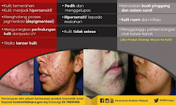 Bahaya Kosmetik Mengandungi Merkuri, Hydroquinone Dan Tretinoin