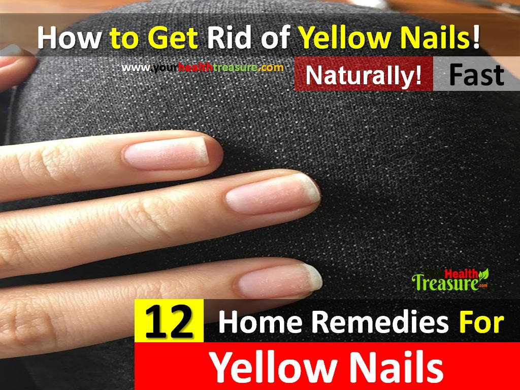 Food Habits To Get Rid Of Pimples Food Habits To Get Rid Of Pimples