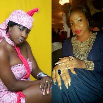 anita joseph bleaching skin