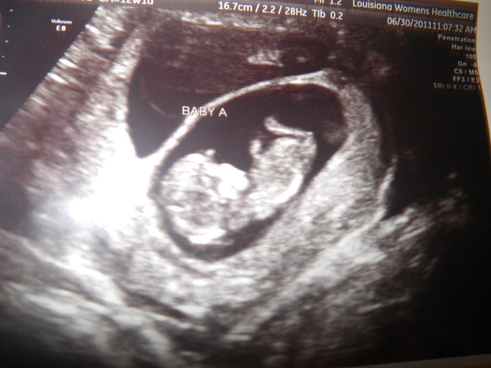 You Could Always Adopt. . .: 12 week ultrasound