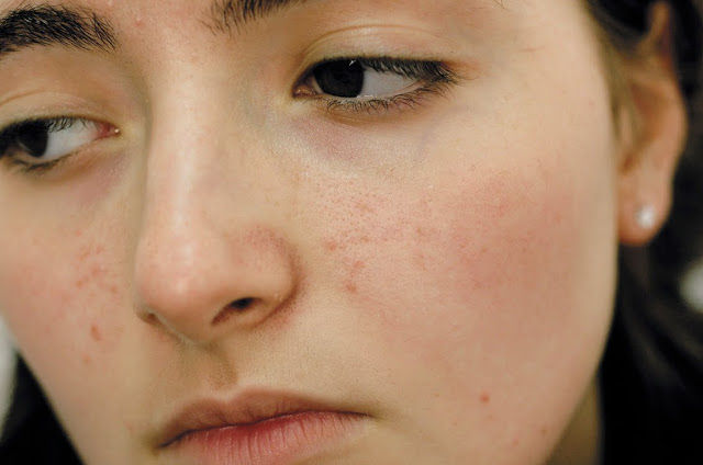 Jarang Disadari Wanita Memakai Masker Seperti Ini Salah Dan Berakhir Fatal Jarang Disadari Wanita Memakai Masker Seperti Ini Salah Dan Berakhir Fatal