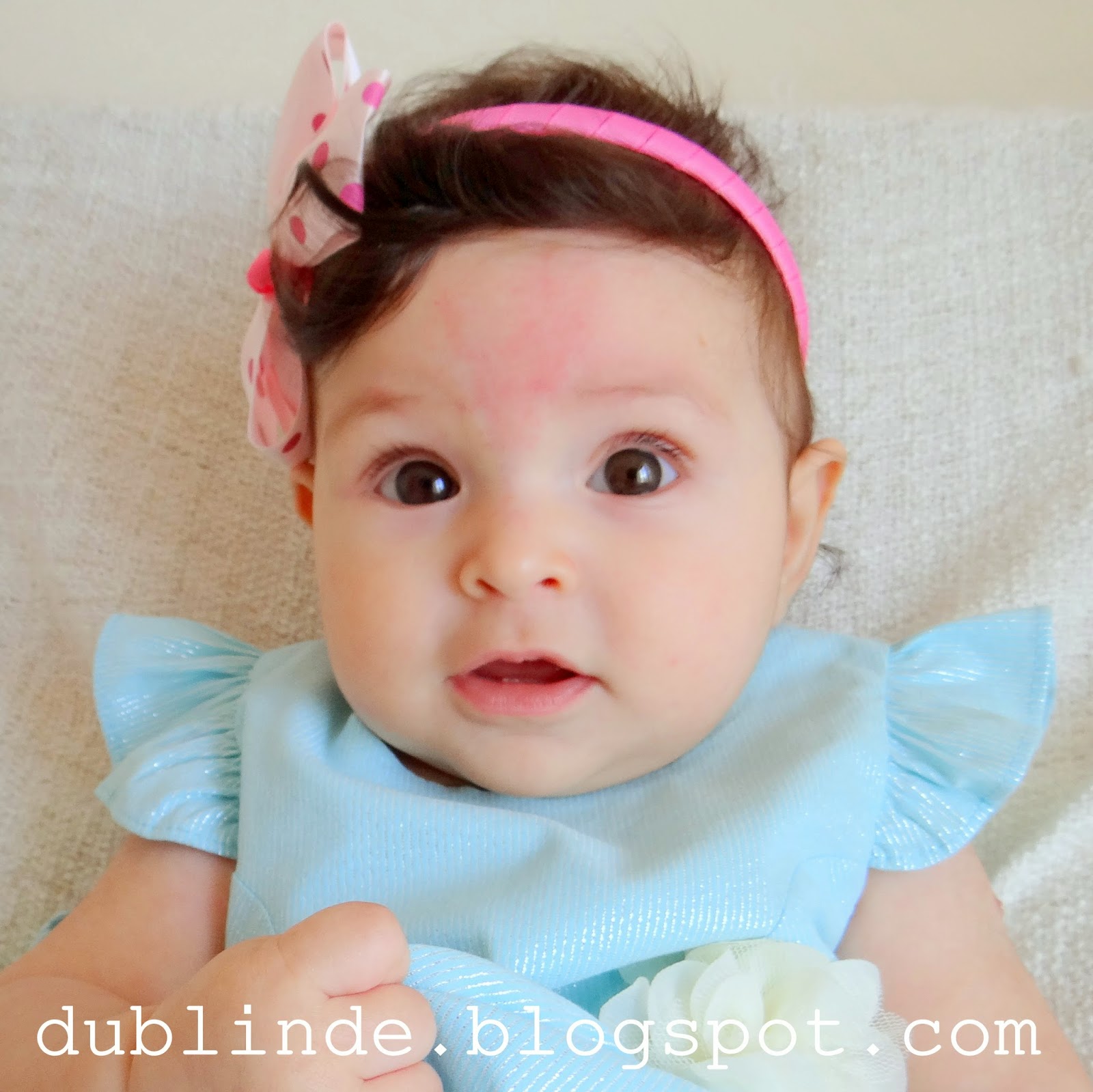 dublinde.. kyla güneş 5 aylık