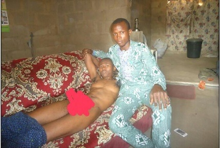 I Want to Be a Man - Nigerian Man With Both Male and Female S*x Organs Cries Out (Photos)