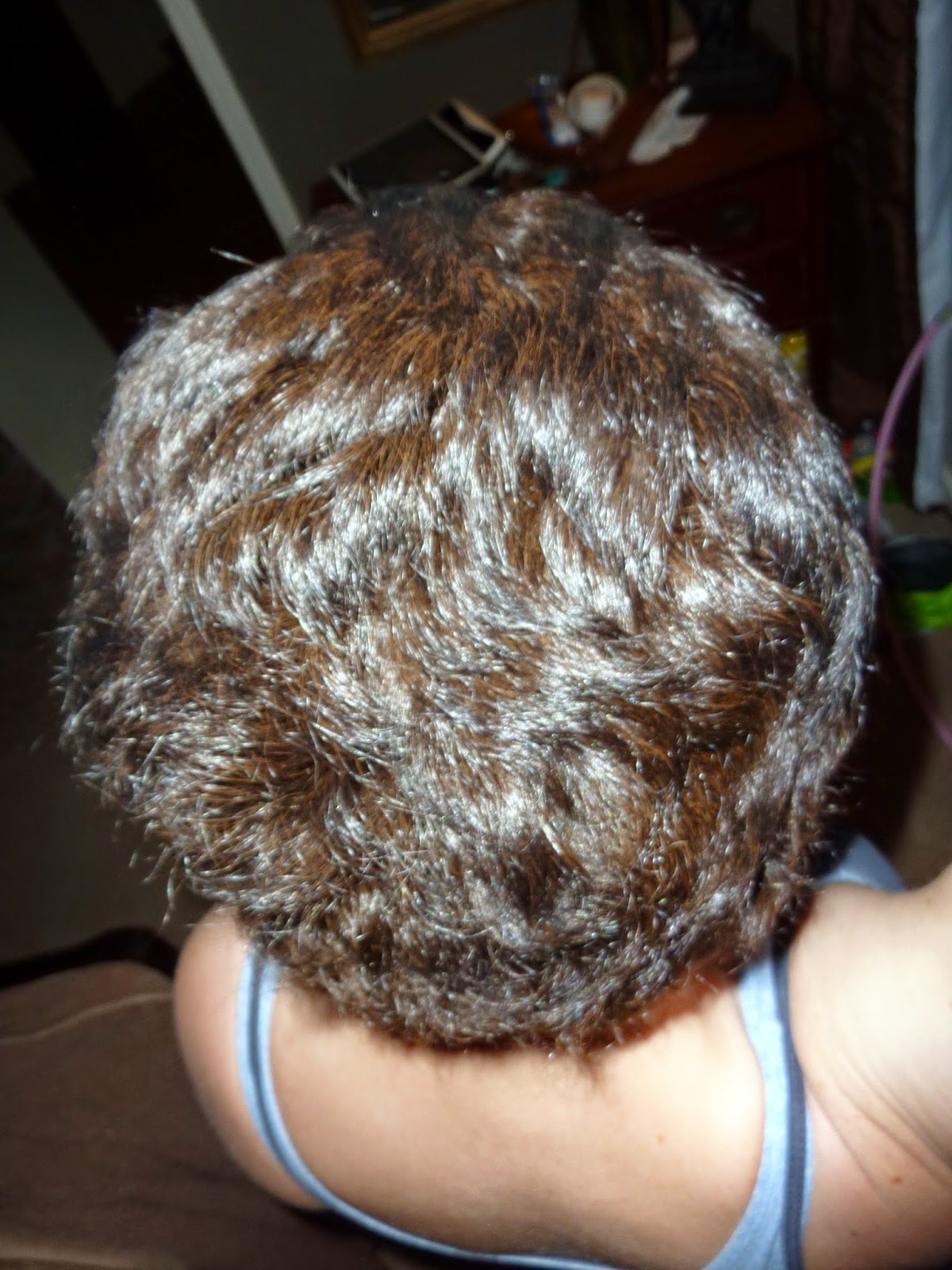 Anncredible: Hair Growth Progression after Chemo- Six Months with UPDATE!