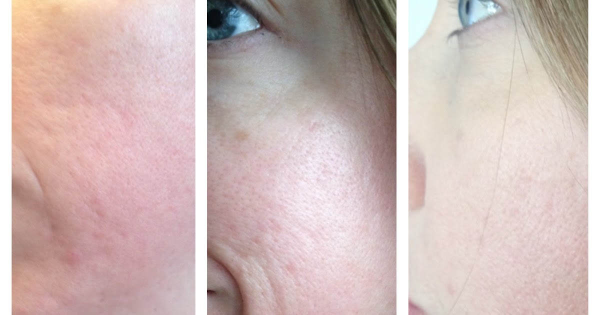 Makeup Artist's Choice Before/After Pics and Testimonials