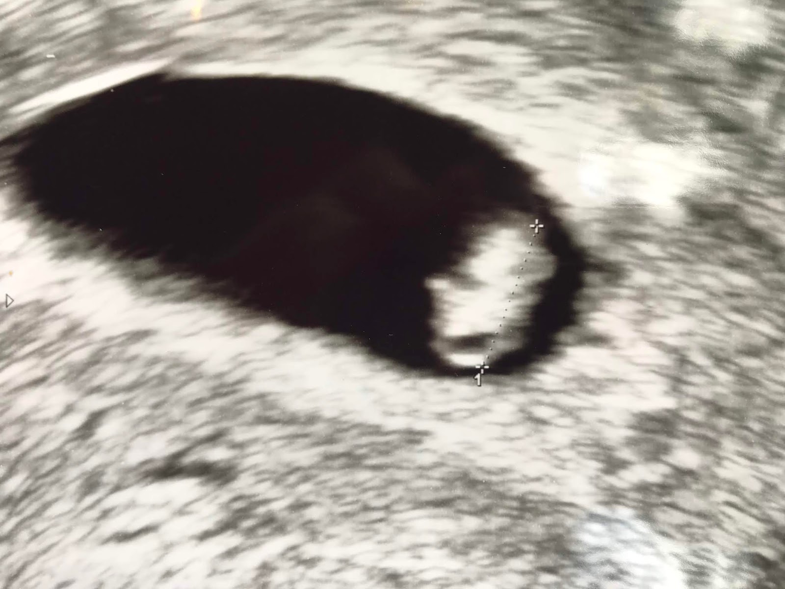 Bt Baby 2010
