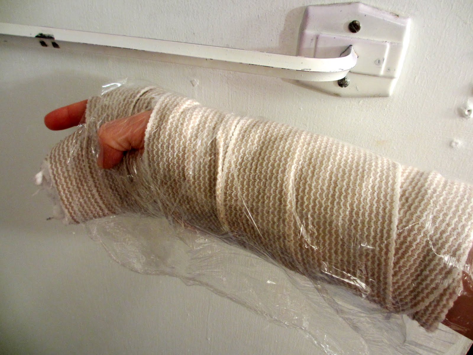 The Daily Apple Apple 617 Showering with a Cast