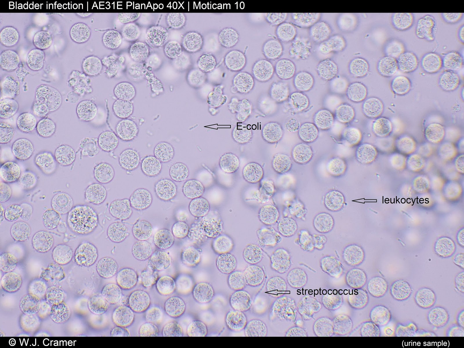 Motic Europe Blog Escherichia coli are usually blamed