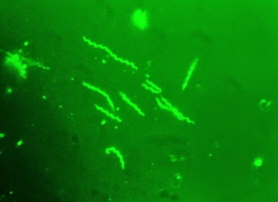 Evolusibilitas Bakteri Lyme Borrelia burgdorferi