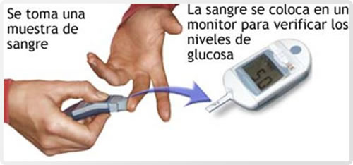 diagnóstico y pruebas de diabetes