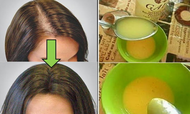 TODOS PERMITEN SORPRENDIDO A LOS MÉDICOS ... SE APLICA ESTE REMEDIO Y CRECERÁ SU GUSTO CABELLO LOCO TODOS PERMITEN SORPRENDIDO A LOS MÉDICOS ... SE APLICA ESTE REMEDIO Y CRECERÁ SU GUSTO CABELLO LOCO