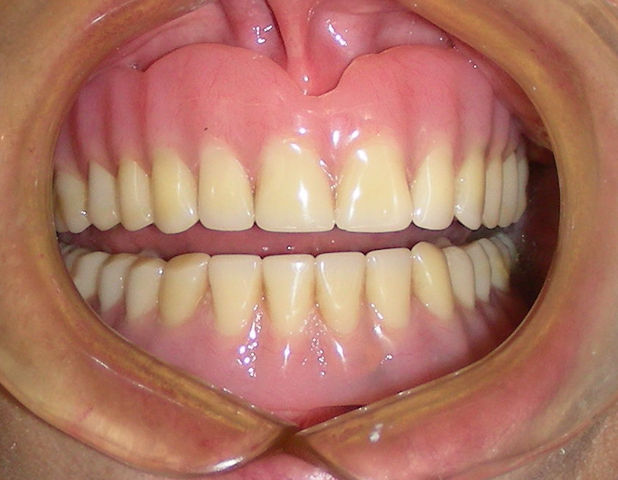 Verano Rehabilitación III: Programa de la asignatura