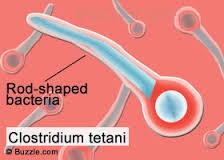Tetanus