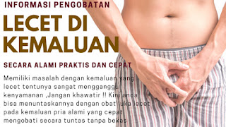 Merk Obat Gejala Penyakit Sipilis Super Ampuh Kemaluan%2Blecet