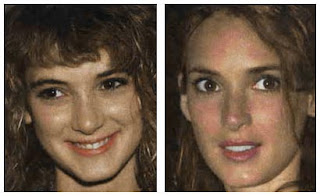 Winona Ryder Nose Job