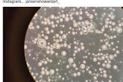 Video 'apparition' Breast Milk in Under the Microscope It So Viral