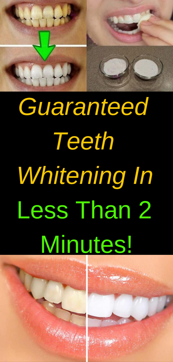 Guaranteed Teeth Whitening In Less Than 2 Minutes! healhty and tips