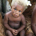 Meet The Only World's Black Blonde Race {Melanesian}