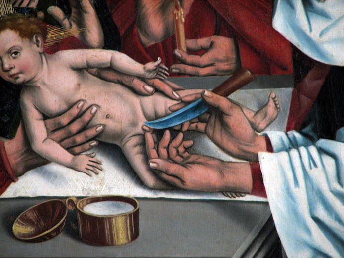 Circumcision of Jesus